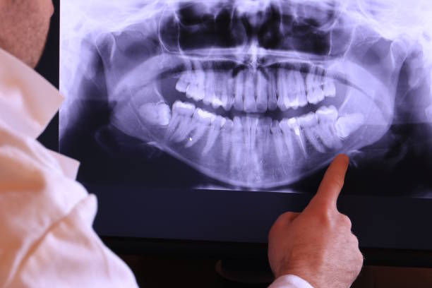 Best Emergency Tooth Extraction in Mineralwells, WV